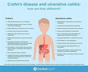 Crohn S Disease And Ulcerative Colitis And How They Are Different