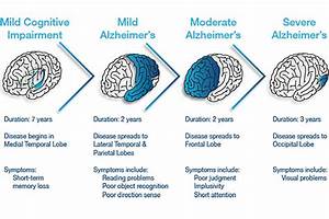 Knowing Alzheimer S Disease Noal