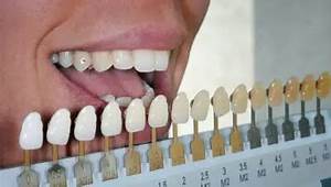 Teeth Color Chart And Natural Tooth Shade Health