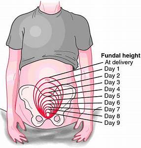 Good Picture To Show Normal Uterine Involution After Delivery Nclex