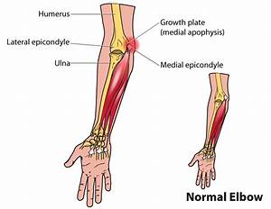 Little Leaguer 39 S Elbow Symptoms Treatment Surgery Pitch Counts