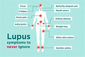 Lupus Signs And Symptoms How To Tell If You Could Have Lupus