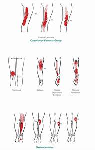  Relief Trigger Point Referral Pattern For The Knee Lower Leg