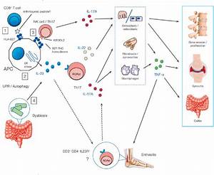 pdf progress in our understanding of the pathogenesis of ankylosing