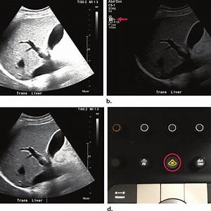 Figure Overall Gain Setting Amplifies All Ultrasound Signals By A