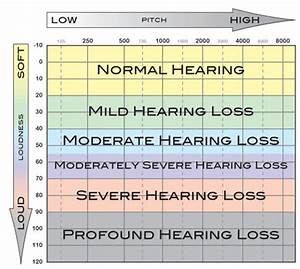 17 Luxury Hearing Frequency Age Chart
