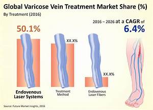 Varicose Vein Treatment Market Global Industry Analysis Size And