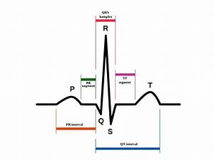 Guía Sanitaria Interpretación Del Electrocardiograma Lo Básico En 7