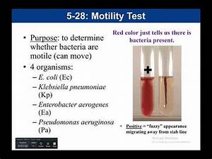 Lab 5 28 Motility Test Youtube