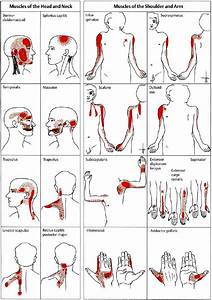 Examples Of Trigger Points And Referred In The Reference Sites