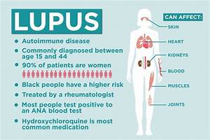 Faits Sur Le Lupus 17 Choses à Savoir Sur Le Lupus Trend Repository