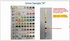 Solved I Need Help With Understanding These Questions Thank You Urine