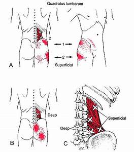 Pin On Si Joint Sciatica Low Back Hips