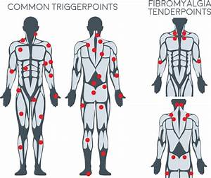 Back Trigger Points Chart Self Trigger Point Guide Body