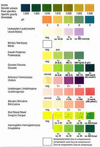 Beautiful Urinalysis Interpretation Chart Chart Gallery 