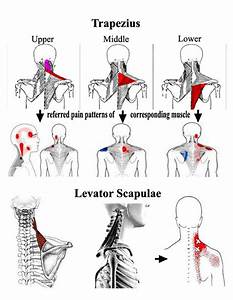 Referred Trigger Points And D 39 Epices On Pinterest