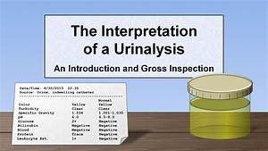 Interpretation Of The Urinalysis Part 1 Introduction And Inspection