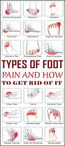Foot Diagnosis Heel