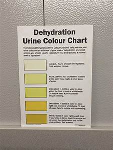 This Urine Dehydration Colour Chart Above The Urinals At Work R