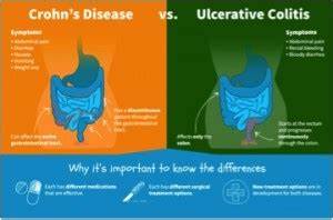 Crohn 39 S Disease Vs Ulcerative Colitis Woburn Osteopaths