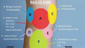 Knee Diagnosis Chart Knee Explained