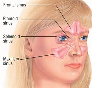 Sinusitis A Very Lowering And Infection Hubpages