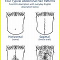 Abdominal Hair Patterns