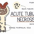 Tubular Necrosis