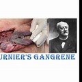 Gangrene Disease