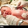 Newborn Baby Being Born