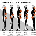 Posture Pain Diagram