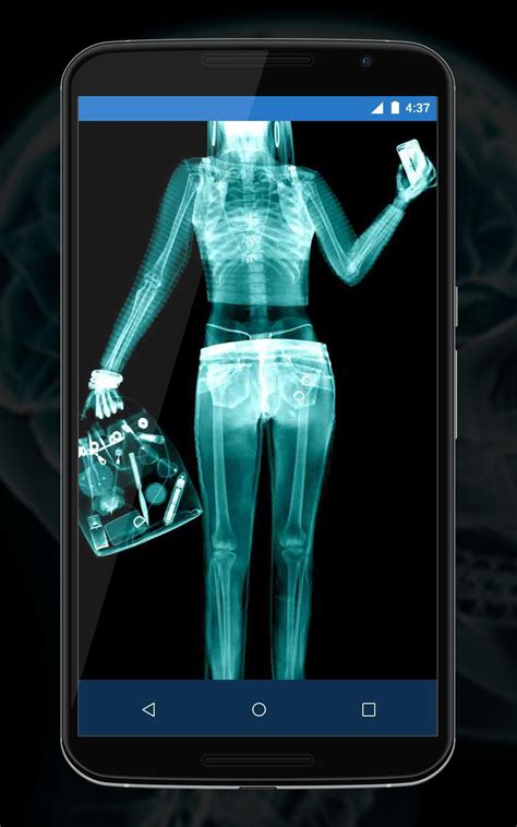 kelebihan aplikasi x ray camera