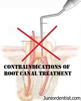 root canal contraindications