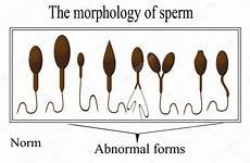 sperm abnormal morphology sperma sperme anormal morphologie normaal sperms defects bentuk penyebab hamil abnormality spermatozoïdes morphological