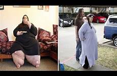 obese amber rachdi morbidly after weight body half