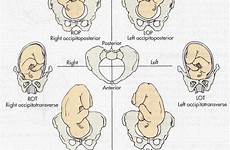fetal position positions baby labor birth nursing positioning roa pregnancy optimal loa posterior lop presentation occiput rop during diagram right