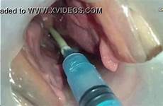 sperm xvideos uterus into injected creampie