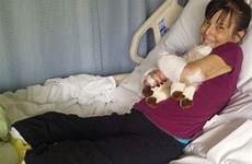 arm legs woman her lost shih tzu loses limbs mummified pet three after mother four dog amputated bite bitten being