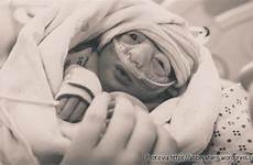 annie anencephaly her parents baby kindness hours but aborted never could ahern lived only lifenews birth after inspires movement