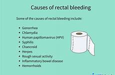 bleeding rectal anus