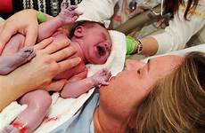 birth giving benefits baby childbirth natural vs midwife midwifery obstetrician woman women huffpost
