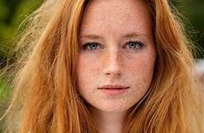 freckles freckle faced redheads pale