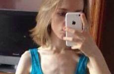 anorexia herself sophie starved 13lbs 5st teenager cheryl weighed shrunk developing hotspot