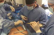 periareolar incision implants