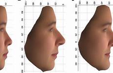 descent analyzed profiles genes pnas