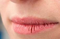 mond droge tandartspraktijk medicijnen lippen augustus eindhoven