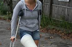 llc gipsbein broken gips crutches casts boots