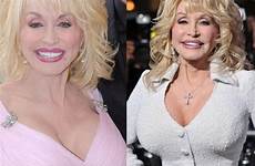 dolly parton surgery plastic breast implants weight before after loss did singer choose board fat she