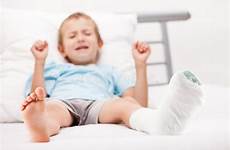 leg child bandage boy fracture little plaster heel br broken preview insurance health