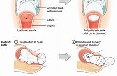 childbirth dilation cervical maternal afterbirth early